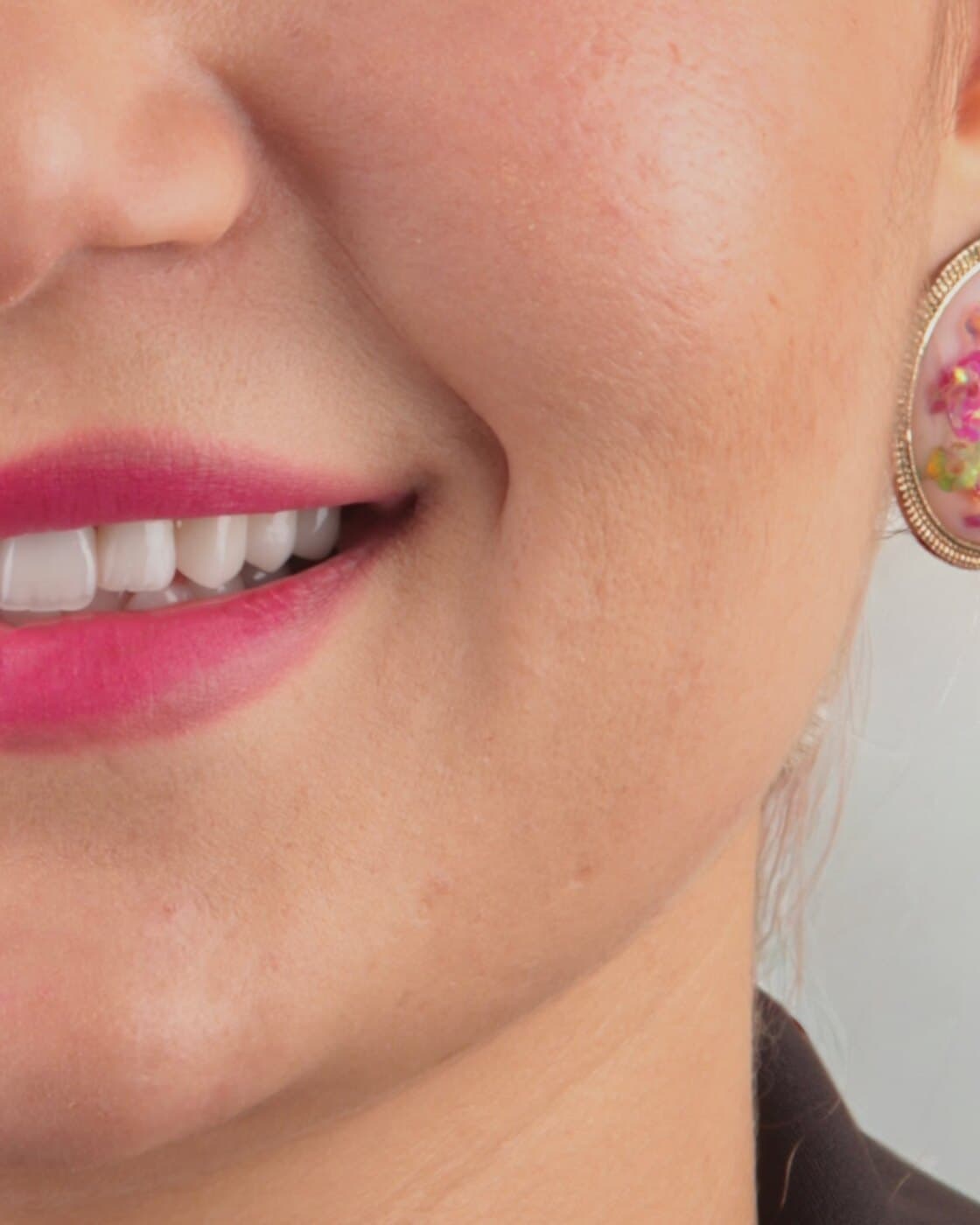 Smile by Dr. Zeen
